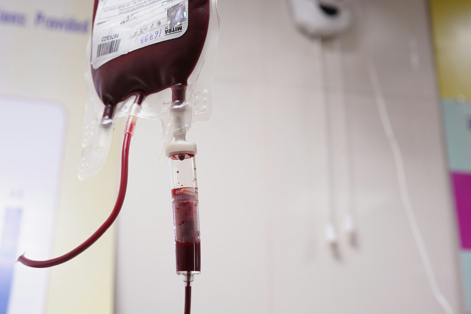 A bag of donated blood hanging from a drip line in a clinic A bag of donated blood hanging from a drip line in a clinic